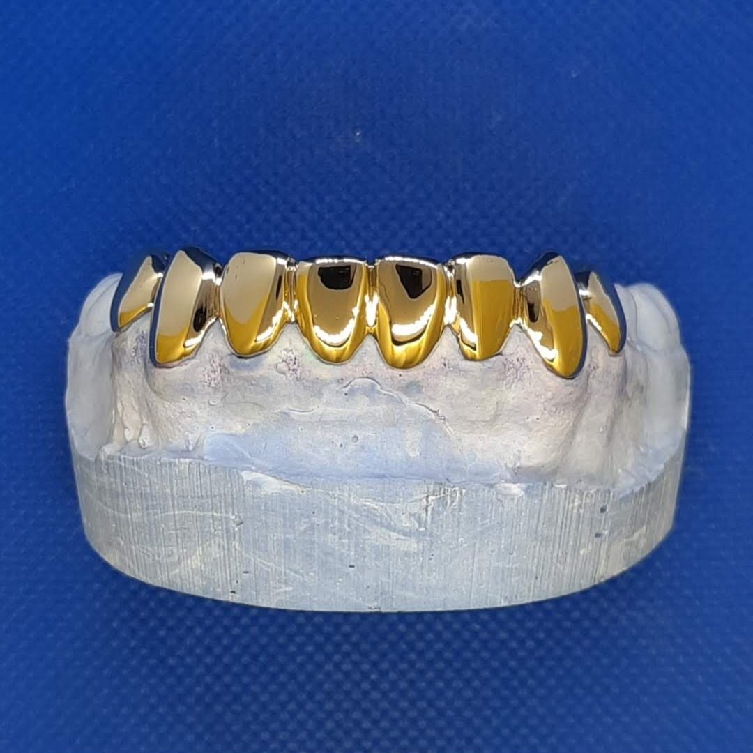 Grillz in 9kt Gold