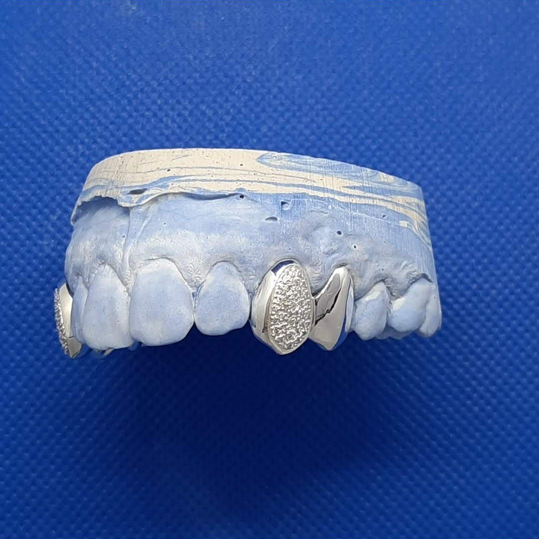 Grillz in Silver